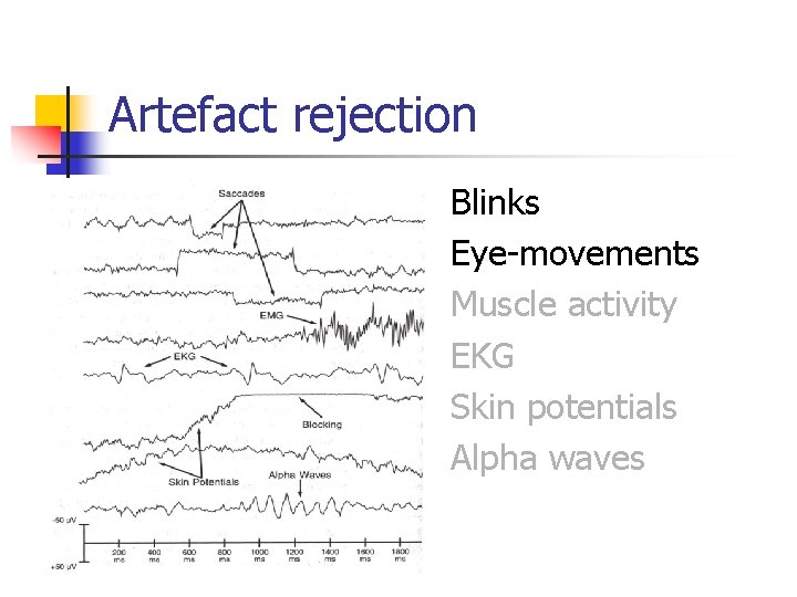 Artefact rejection Blinks Eye-movements Muscle activity EKG Skin potentials Alpha waves 