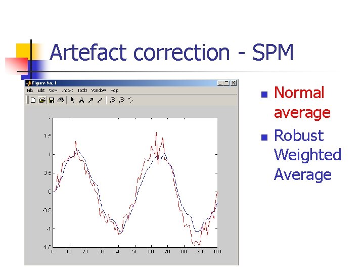 Artefact correction - SPM n n Normal average Robust Weighted Average 