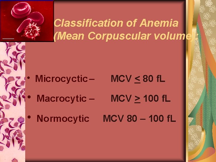 Classification of Anemia (Mean Corpuscular volume): h Microcyctic – MCV < 80 f. L