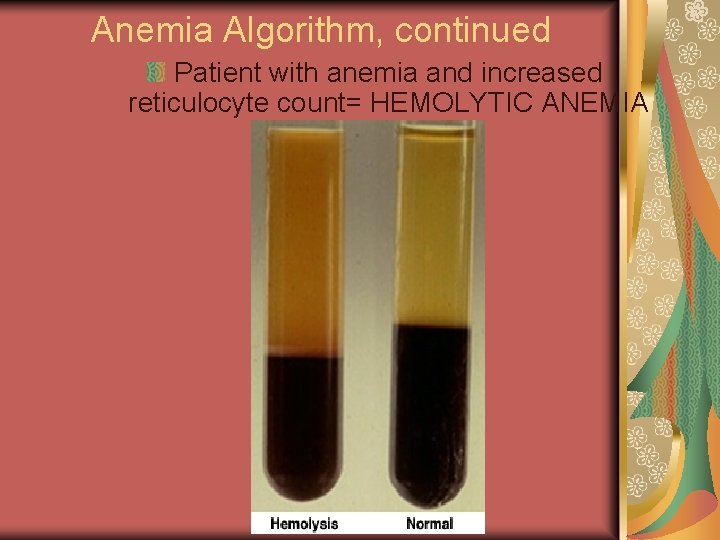 Anemia Algorithm, continued Patient with anemia and increased reticulocyte count= HEMOLYTIC ANEMIA 