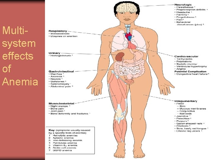 Multisystem effects of Anemia 