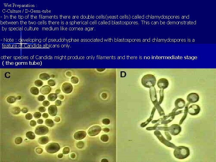  Wet Preparation : C-Culture / D-Germ-tube - In the tip of the filaments