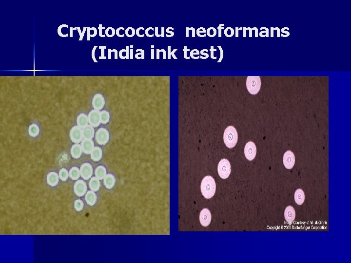  Cryptococcus neoformans (India ink test) 