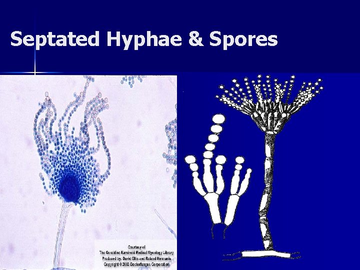  Septated Hyphae & Spores 