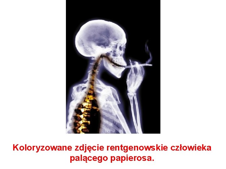 Koloryzowane zdjęcie rentgenowskie człowieka palącego papierosa. 
