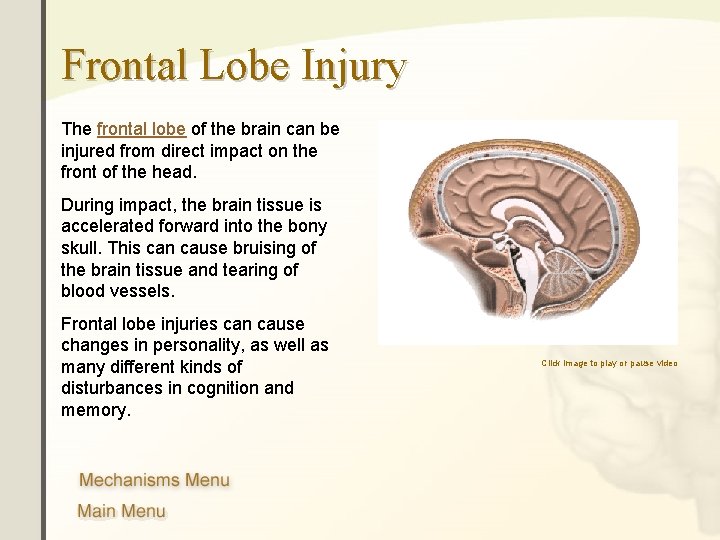 Frontal Lobe Injury The frontal lobe of the brain can be injured from direct Frontal Lobe Injury The frontal lobe of the brain can be injured from direct