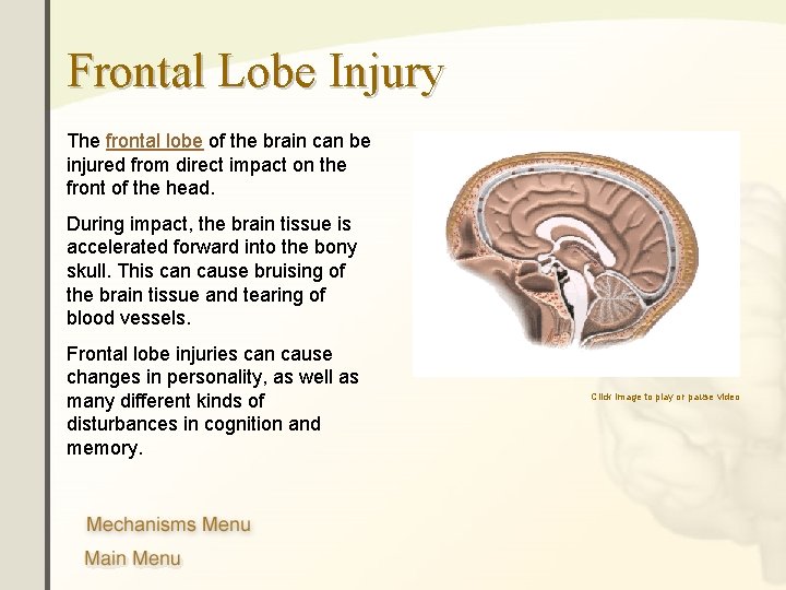 Frontal Lobe Injury The frontal lobe of the brain can be injured from direct