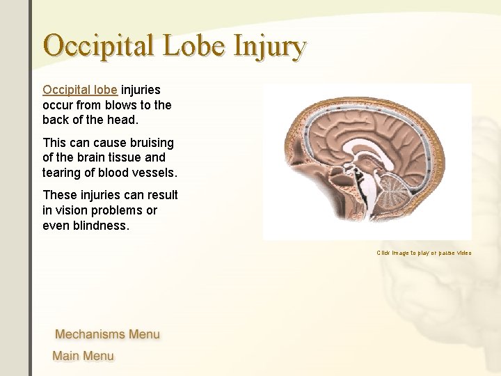 Occipital Lobe Injury Occipital lobe injuries occur from blows to the back of the Occipital Lobe Injury Occipital lobe injuries occur from blows to the back of the