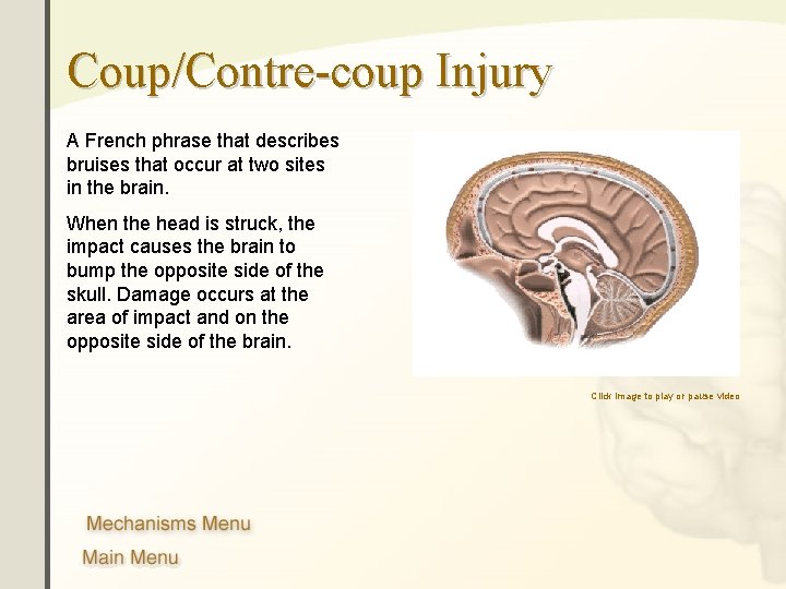 Coup/Contre-coup Injury A French phrase that describes bruises that occur at two sites in