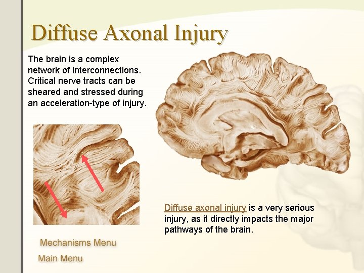 Diffuse Axonal Injury The brain is a complex network of interconnections. Critical nerve tracts
