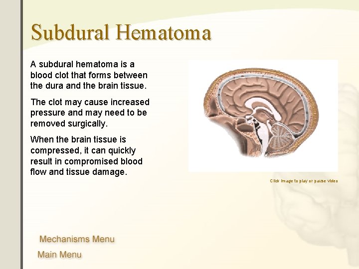 Subdural Hematoma A subdural hematoma is a blood clot that forms between the dura