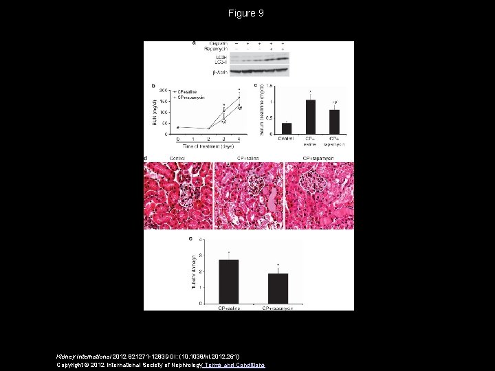 Figure 9 Kidney International 2012 821271 -1283 DOI: (10. 1038/ki. 2012. 261) Copyright ©