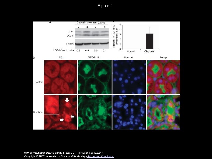 Figure 1 Kidney International 2012 821271 -1283 DOI: (10. 1038/ki. 2012. 261) Copyright ©