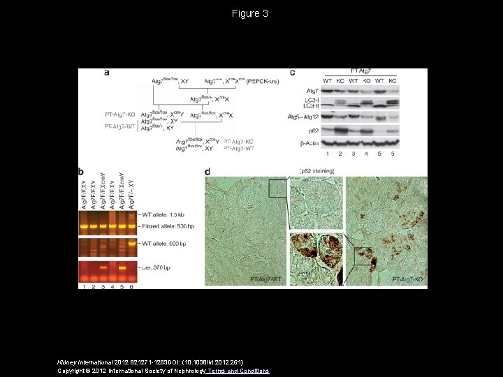 Figure 3 Kidney International 2012 821271 -1283 DOI: (10. 1038/ki. 2012. 261) Copyright ©