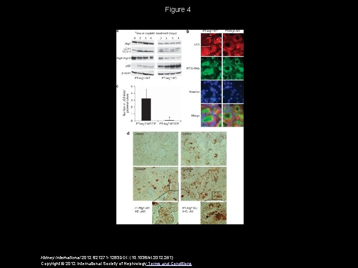 Figure 4 Kidney International 2012 821271 -1283 DOI: (10. 1038/ki. 2012. 261) Copyright ©