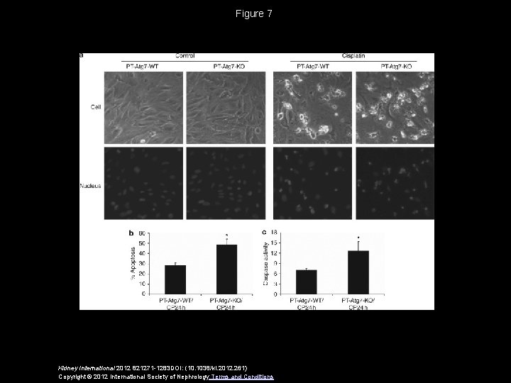 Figure 7 Kidney International 2012 821271 -1283 DOI: (10. 1038/ki. 2012. 261) Copyright ©