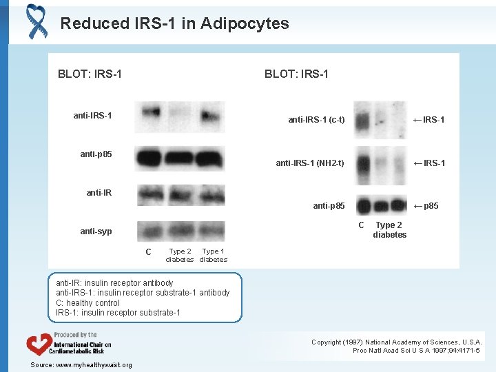 Reduced IRS-1 in Adipocytes BLOT: IRS-1 anti-IRS-1 anti-p 85 anti-IRS-1 (c-t) ← IRS-1 anti-IRS-1