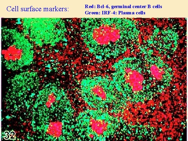Cell surface markers: Red: Bcl-6, germinal center B cells Green: IRF-4: Plasma cells 