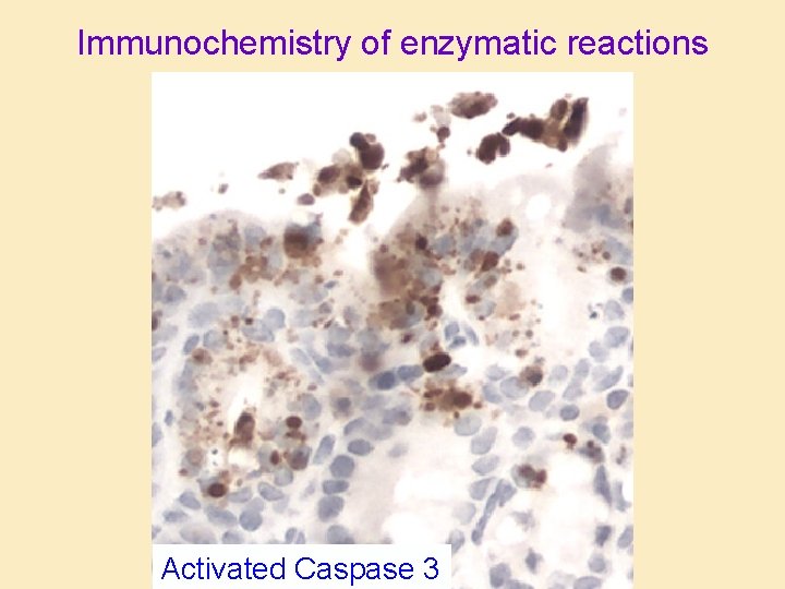 Immunochemistry of enzymatic reactions Activated Caspase 3 