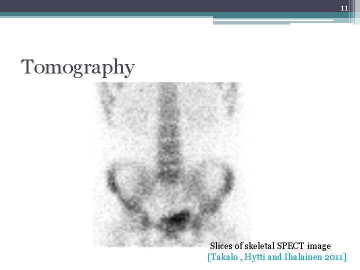 11 Tomography Slices of skeletal SPECT image [Takalo , Hytti and Ihalainen 2011] 