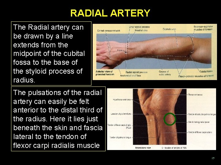 RADIAL ARTERY The Radial artery can be drawn by a line extends from the