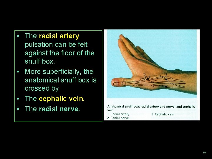  • The radial artery pulsation can be felt against the floor of the