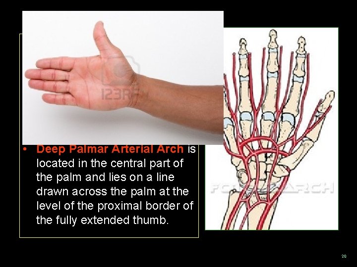  • Superficial Palmar Arterial Arch is located in the central part of the