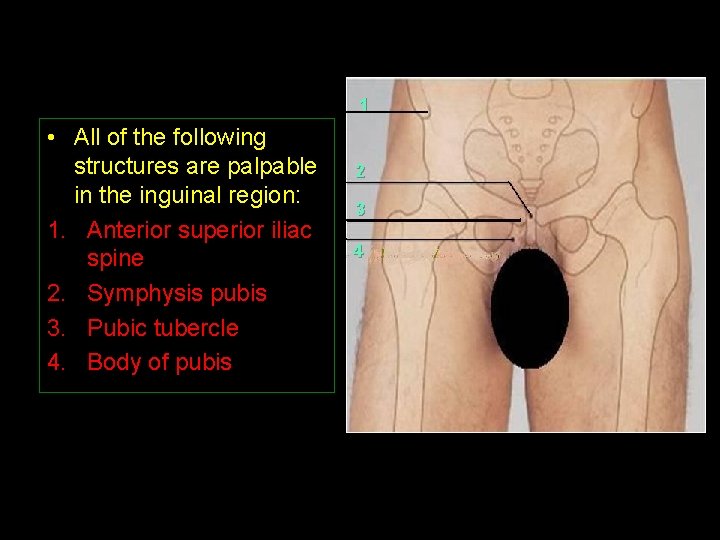 1 • All of the following structures are palpable in the inguinal region: 1.