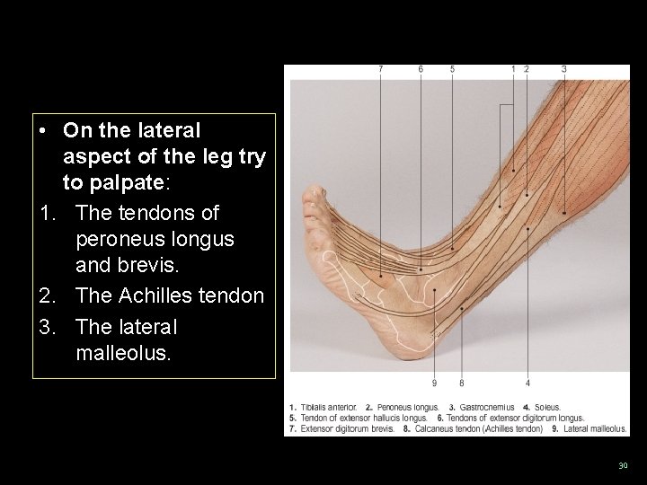  • On the lateral aspect of the leg try to palpate: 1. The