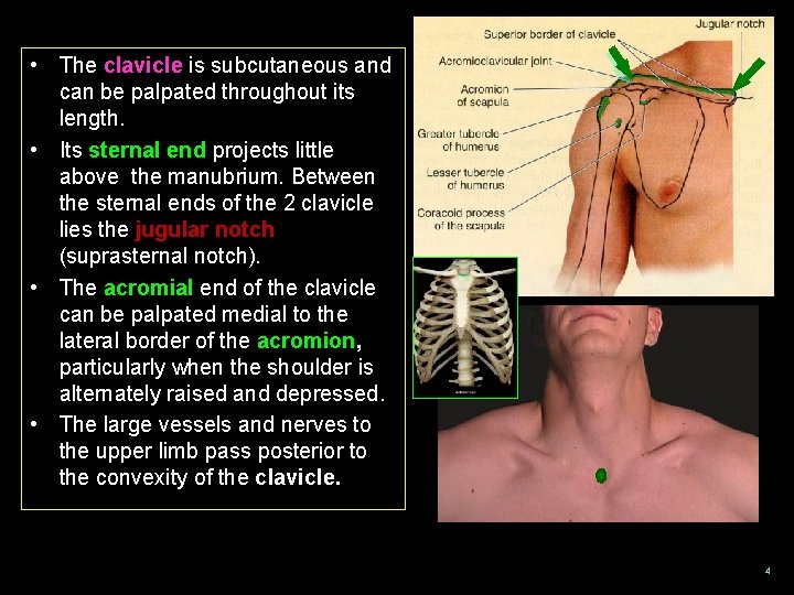  • The clavicle is subcutaneous and can be palpated throughout its length. •