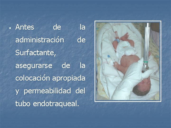  • Antes de la administración de Surfactante, asegurarse de la colocación apropiada y