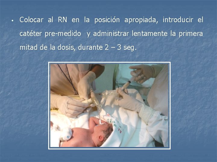 • Colocar al RN en la posición apropiada, introducir el catéter pre-medido y