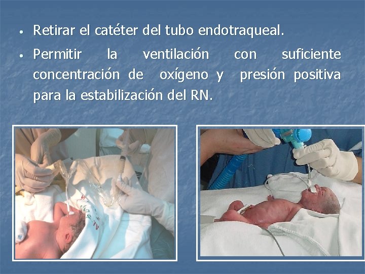  • Retirar el catéter del tubo endotraqueal. • Permitir la ventilación con suficiente