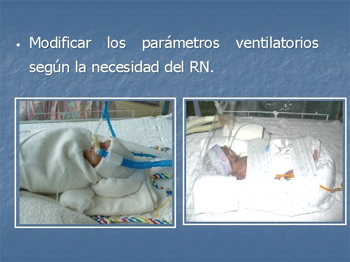  • Modificar los parámetros ventilatorios según la necesidad del RN. 