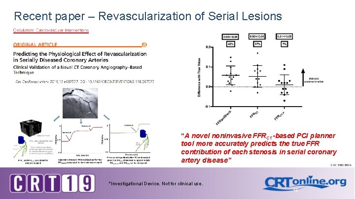 Recent paper – Revascularization of Serial Lesions “A novel noninvasive FFRCT-based PCI planner tool