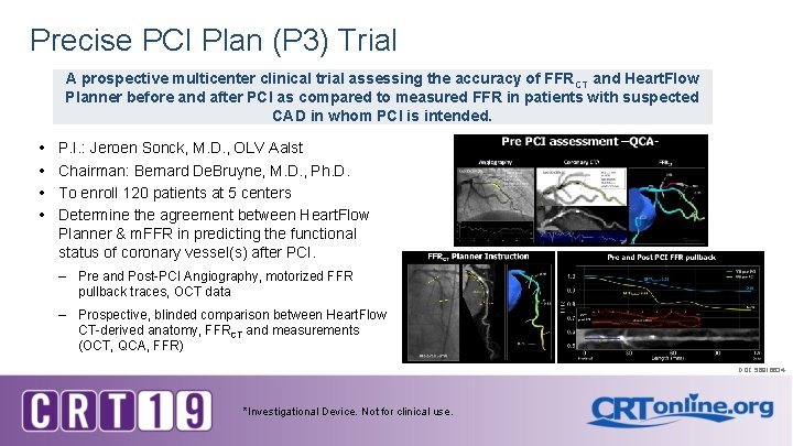 Precise PCI Plan (P 3) Trial A prospective multicenter clinical trial assessing the accuracy