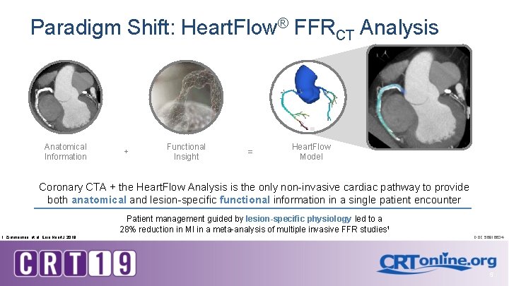 Paradigm Shift: Heart. Flow® FFRCT Analysis Anatomical Information + Functional Insight = Heart. Flow