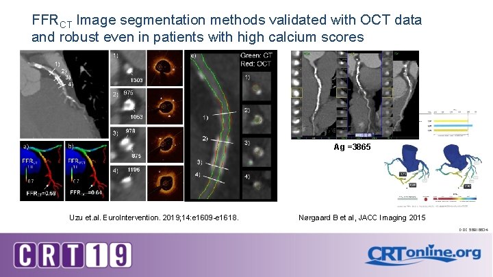 FFRCT Image segmentation methods validated with OCT data and robust even in patients with