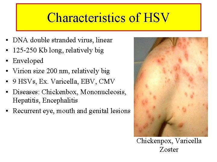 Characteristics of HSV • • • DNA double stranded virus, linear 125 -250 Kb