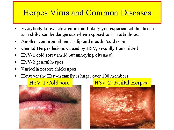 Herpes Virus and Common Diseases • Everybody knows chickenpox and likely you experienced the