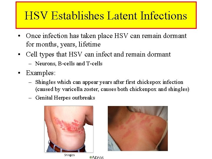 HSV Establishes Latent Infections • Once infection has taken place HSV can remain dormant