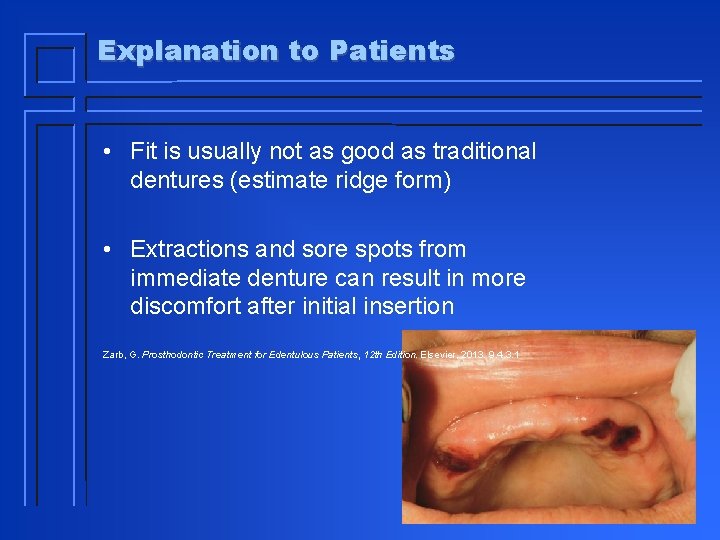 Explanation to Patients • Fit is usually not as good as traditional dentures (estimate