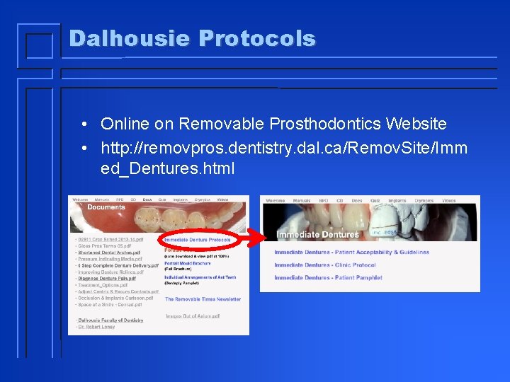 Dalhousie Protocols • Online on Removable Prosthodontics Website • http: //removpros. dentistry. dal. ca/Remov.