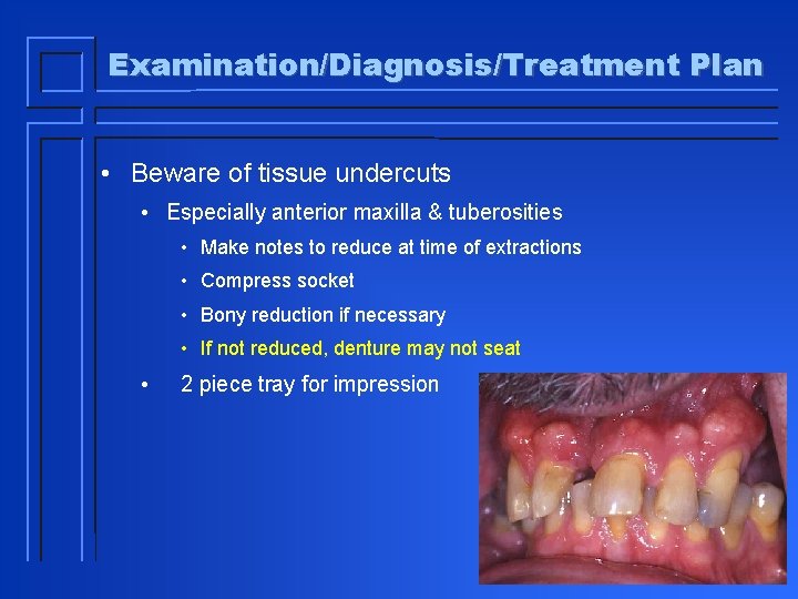 Examination/Diagnosis/Treatment Plan • Beware of tissue undercuts • Especially anterior maxilla & tuberosities •