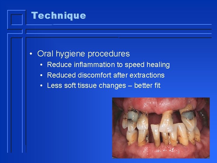 Technique • Oral hygiene procedures • Reduce inflammation to speed healing • Reduced discomfort