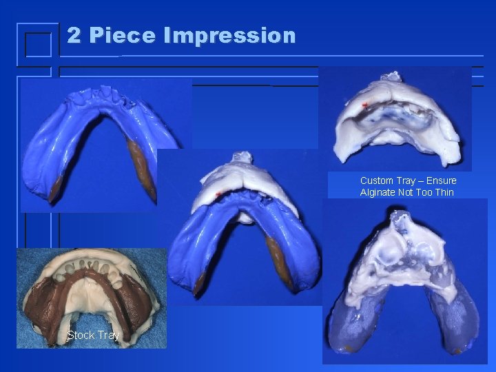 2 Piece Impression Custom Tray – Ensure Alginate Not Too Thin Stock Tray 