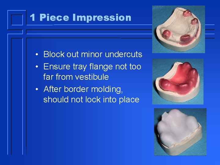 1 Piece Impression • Block out minor undercuts • Ensure tray flange not too