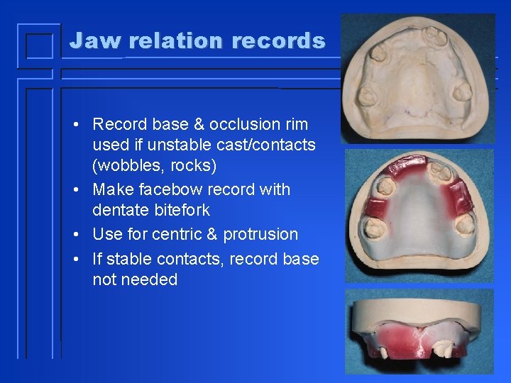 Jaw relation records • Record base & occlusion rim used if unstable cast/contacts (wobbles,