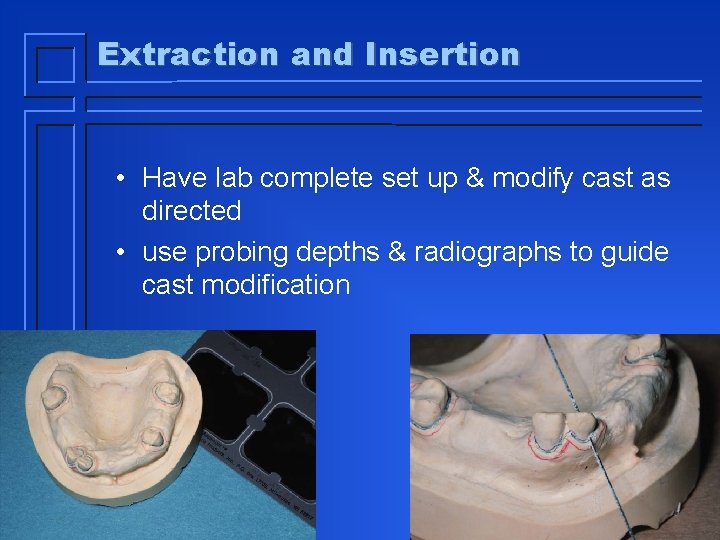 Extraction and Insertion • Have lab complete set up & modify cast as directed