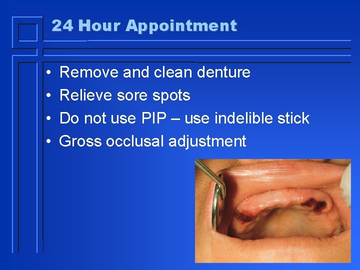 24 Hour Appointment • • Remove and clean denture Relieve sore spots Do not